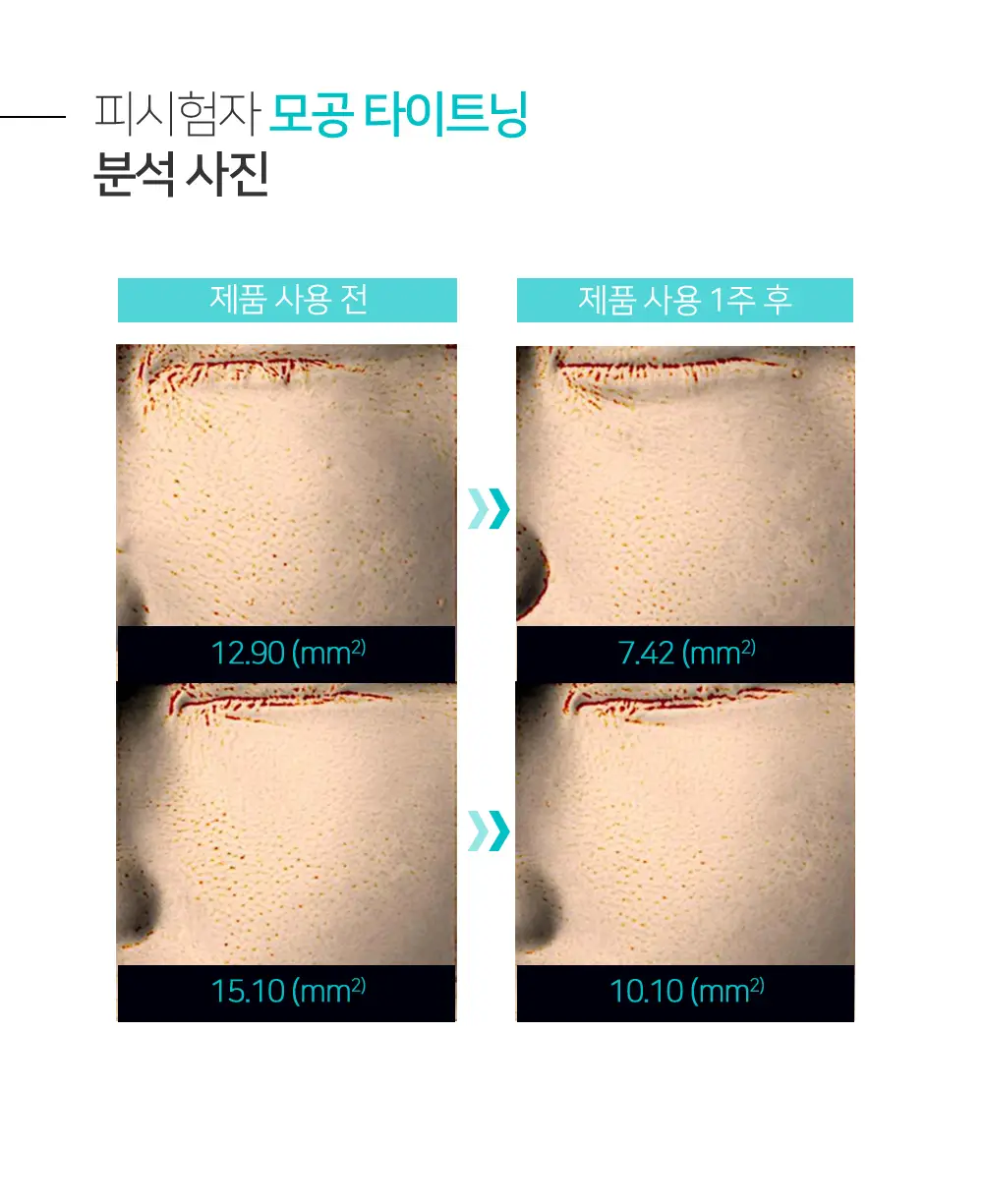 [숌.민감피부] 수분충전 소프트 클렌징밤 1+1기획 상세페이지 26